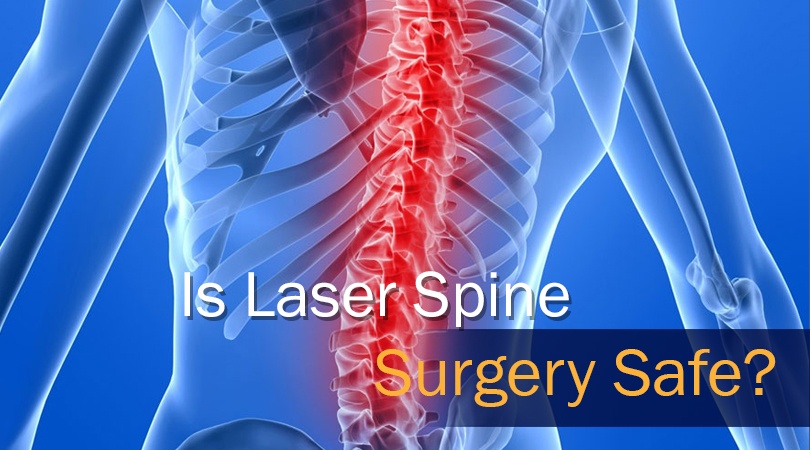 Is Laser Spine Surgery Safe?